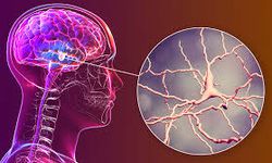 Parkinson hastalığında erken teşhisin önemi artıyor