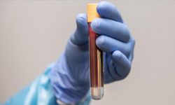 Kanserde genetik testlerin dört önemli faydası