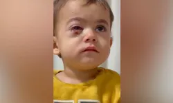Bursa’da 2 yaşındaki çocuk sağ gözünü kaybetti