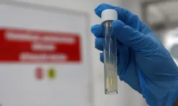 Tüberküloz geçen yıl 1,23 milyon can aldı