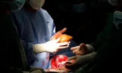 ABD'de bir hasta böbrek nakli sonrası kuduzdan yaşamını yitirdi