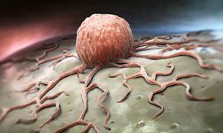 Günde sadece 5 tane yemek yetiyor! Kansere resmen savaş açıyor