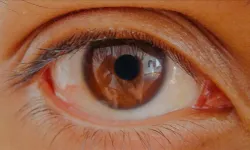 Göz tansiyonunda erken teşhis kalıcı körlüğü önlüyor