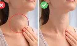 Evde tiroid kontrolü: Ayna testi nasıl yapılır?