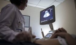 Çikolata kisti her 10 kadından birini etkiliyor