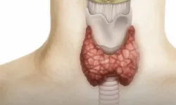Tiroid kanserinde erken uyarı veren belirtiler