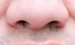 Burun kılları tozlu havaya karşı doğal filtre görevi görüyor