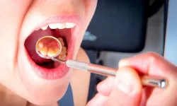 Damak şişmesine yol açan hatalara dikkat