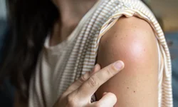 Kollardaki pütürlü doku ne anlatıyor?