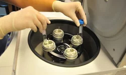 SGK tüp bebek desteğinde 2026 şartlarını açıkladı