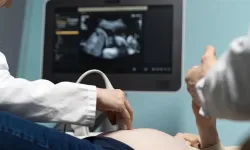 PCOS’un adı PMOS olarak değiştirildi
