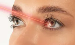 Smile Pro lazer ile göz tedavisinde yeni dönem