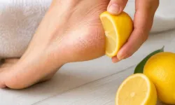 Ayak topuğuna limon sürmek çatlağı ve kuruluğu azaltır mı?