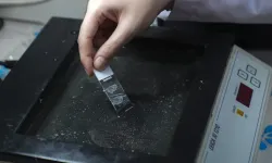 Diş kök hücreleri çikolata kisti tedavisine umut oldu