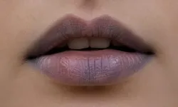 Dudak rengi neden koyulaşır? İşte sebebi