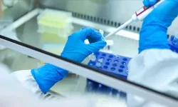 Kanser riski en yüksek meslekler araştırıldı