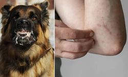 Kuduzda ısırık ve tırmalama sonrası ilk 15 dakika önemli