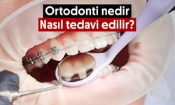 Ortodonti nedir ve nasıl tedavi edilir?