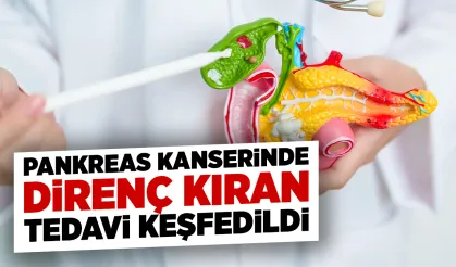 Pankreas kanserinde tümör direncini kıran yeni yöntem