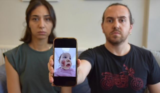 Kızları kreşteki çocuklar tarafından darbedilen aile şikayetçi oldu