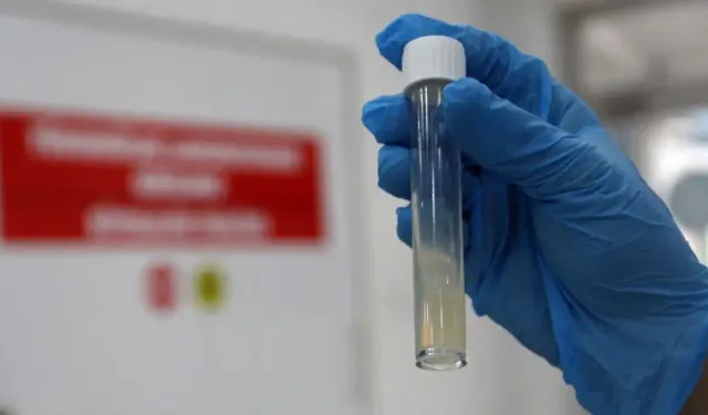 Tüberküloz geçen yıl 1,23 milyon can aldı