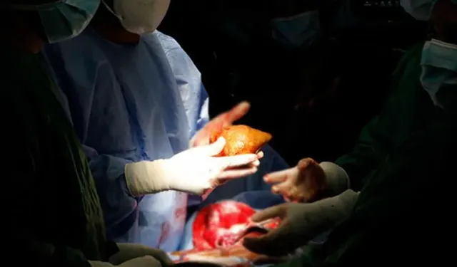 ABD'de bir hasta böbrek nakli sonrası kuduzdan yaşamını yitirdi