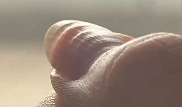 Dalgalı tırnak neyin habercisi? Vücut bu şekilde uyarı verebilir