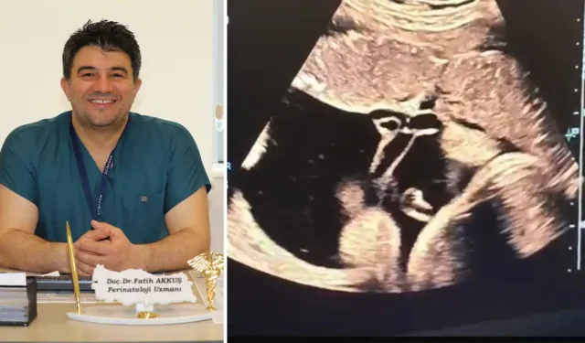 Kütahya'da anne karnındaki bebeğe kan nakli yapıldı