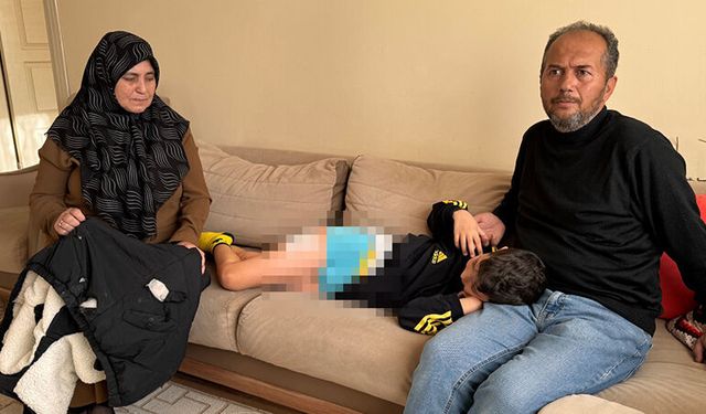 Kütahya'da köpeklerin saldırdığı 9 yaşındaki çocuk yaralandı