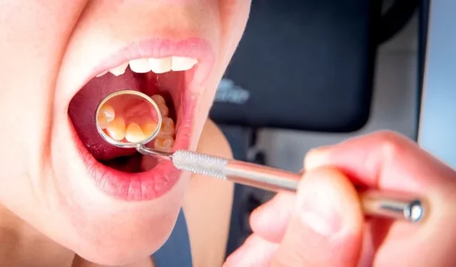 Damak şişmesine yol açan hatalara dikkat