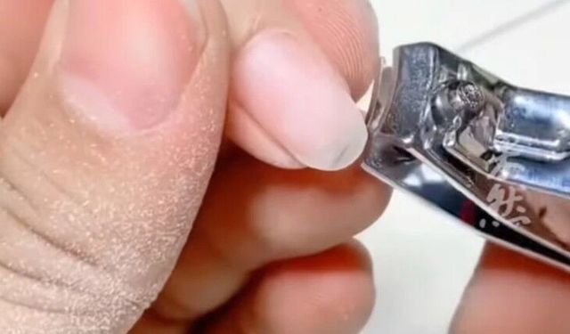 Kestiği tırnakları biriktirdi, ticarete çevirdi: Kiloyla satıyor