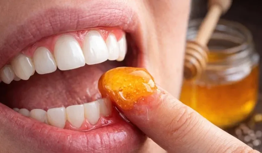 Diş eti sorunlarına doğal destek: Balın ağız ve diş sağlığına etkisi