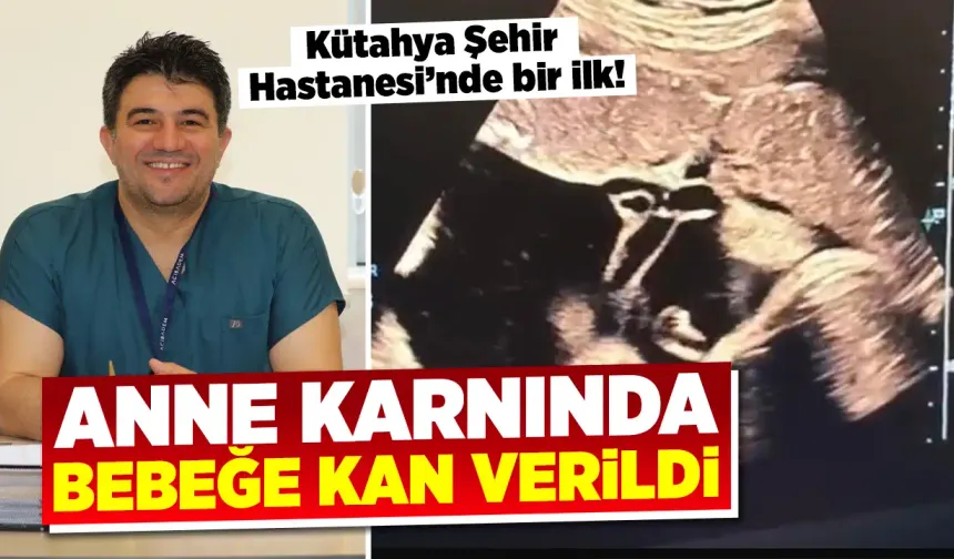 Kütahya'da anne karnındaki bebeğe kan nakli yapıldı