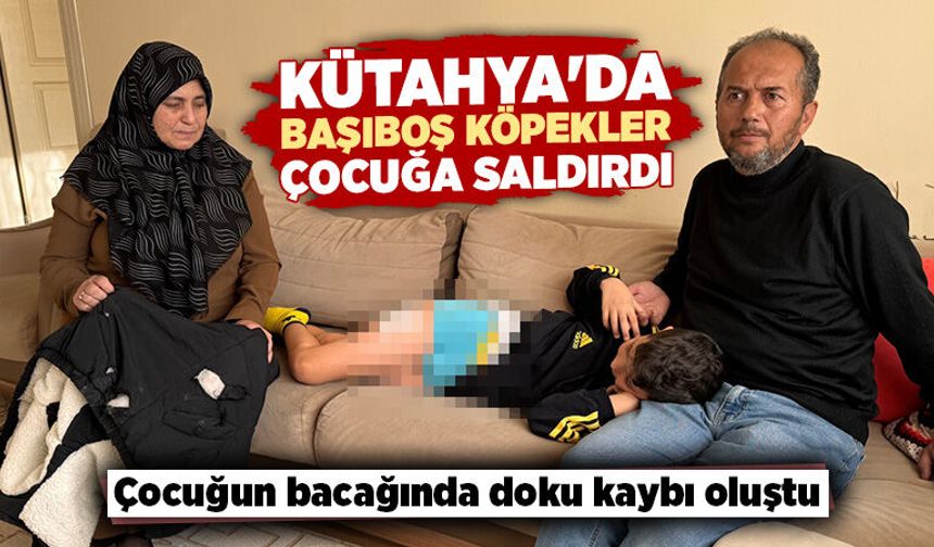 Kütahya'da köpeklerin saldırdığı 9 yaşındaki çocuk yaralandı