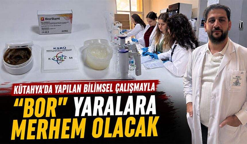 Kütahya’da bor ve gümüş içerikli yara kremleri geliştirildi