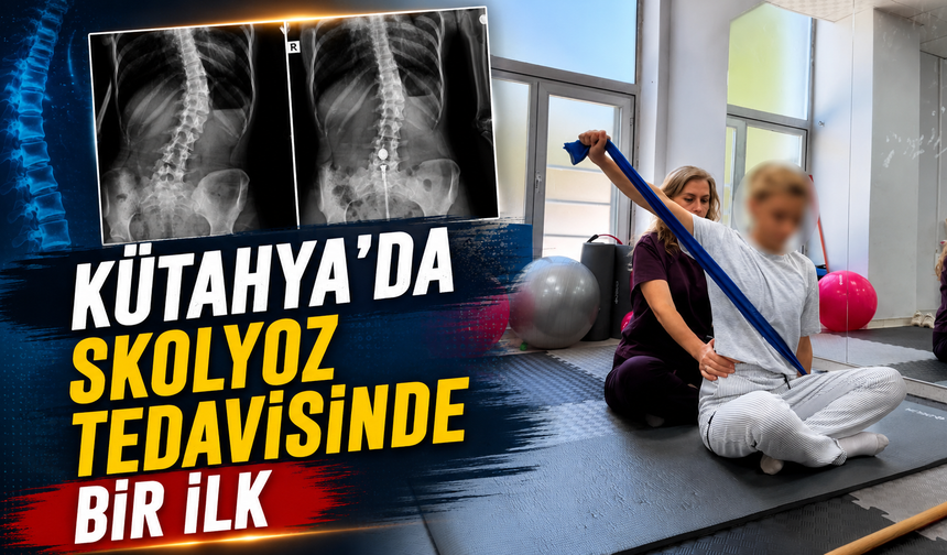 Kütahya’da skolyoz tedavisinde bir ilk gerçekleştirildi