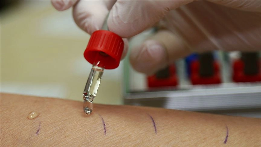 Alerji Mi, Soğuk Algınlığı Mı Uzmanlar Uyarıyor! (2)