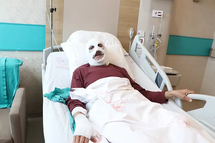 Gaz Kaçağını Çakmakla Kontrol Eden Yaşlı Adam Yangında Ağır Yaralandı