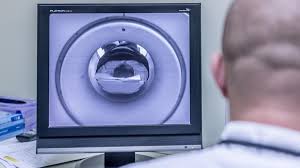 19 Yaşındaki Genç Alzheimer Teşhisiyle Şoke Etti