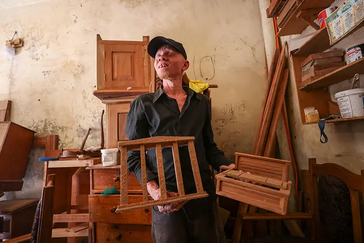 Sanat Ve Zanaat Yoluyla Senegalli Albinoların Önyargılarla Savaşı1