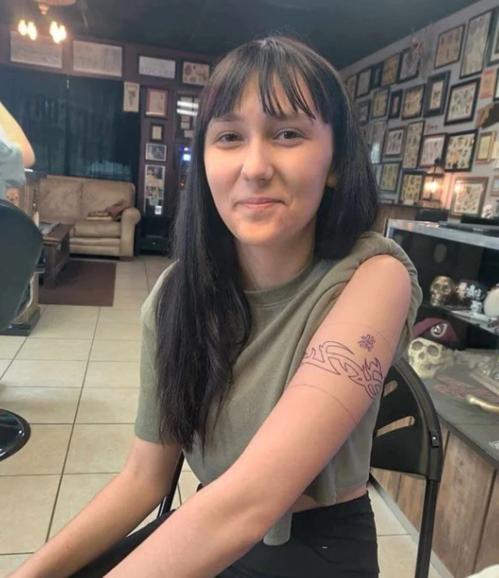 Saç Boyası Genç Kızı Hastanelik Etti Kafasında Delik Açıldı-1