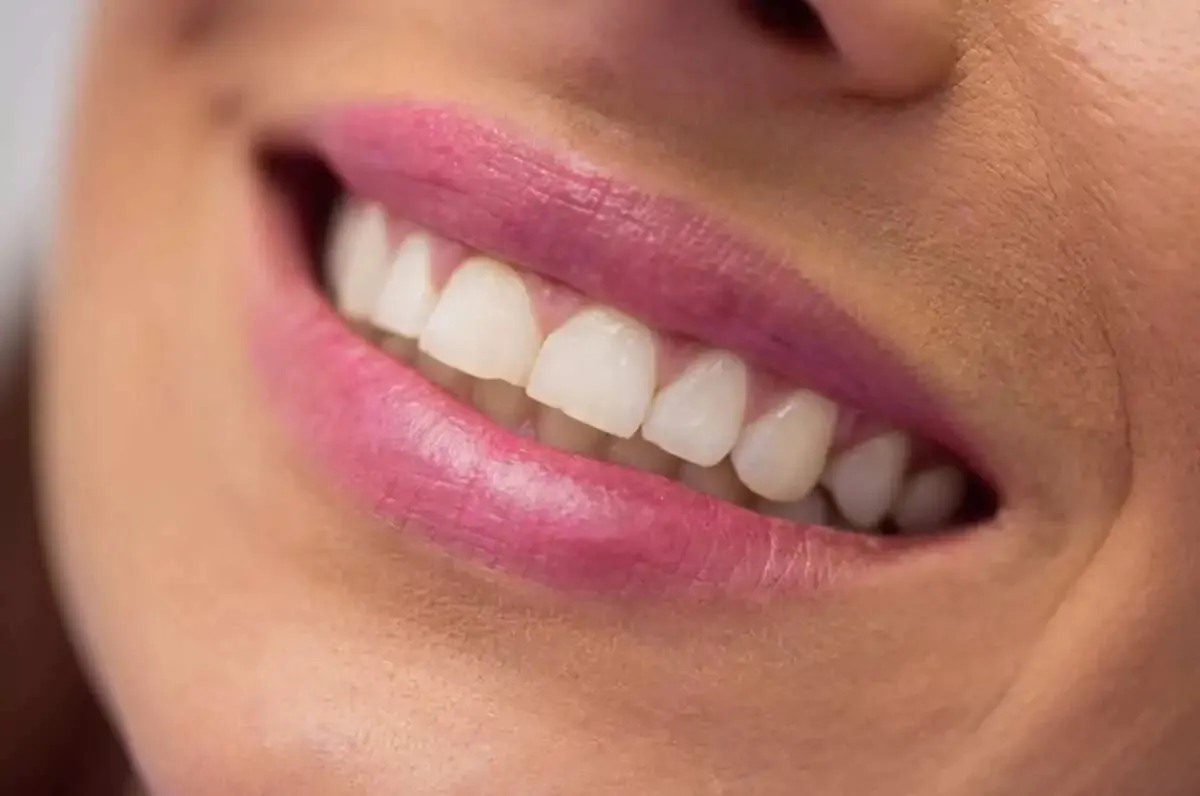 Dişlerinizin Rengine Dikkat1