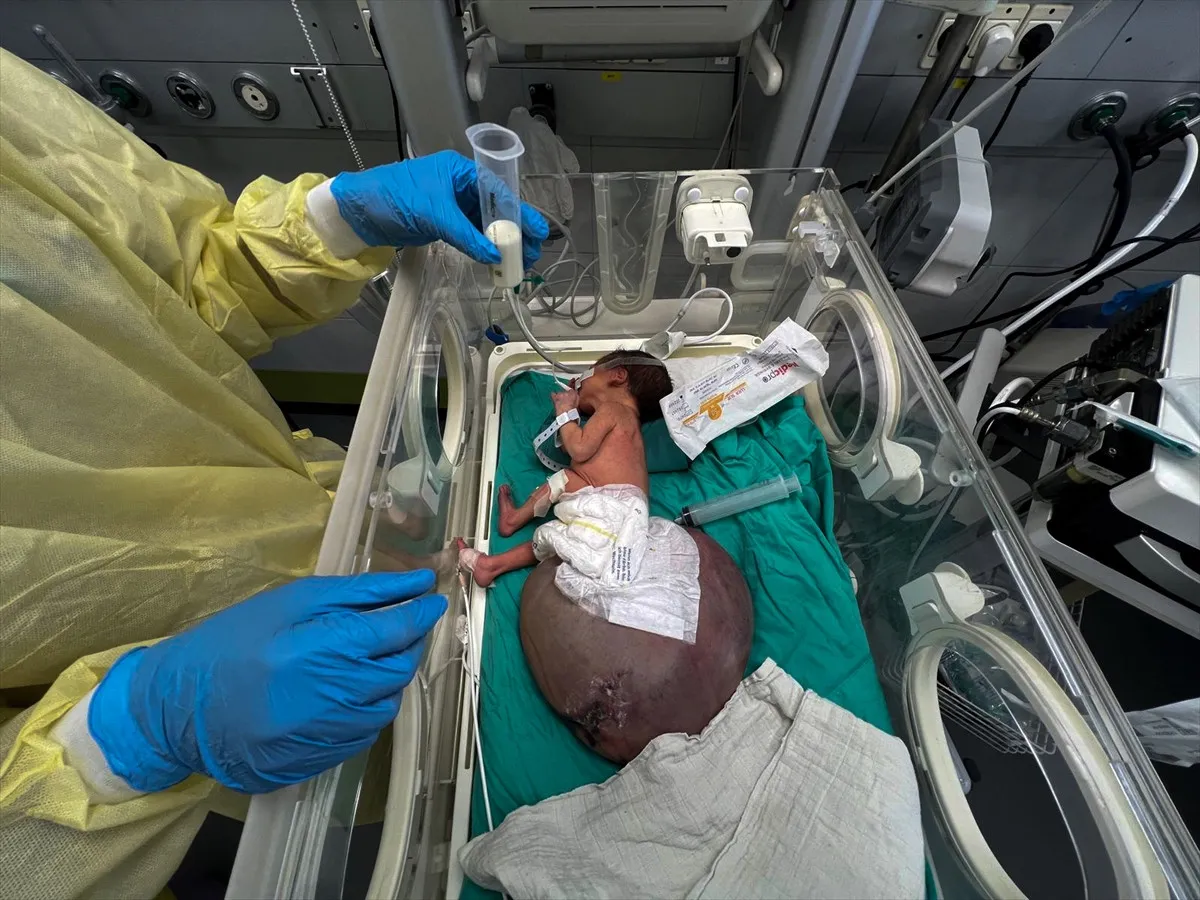 Gazze'de Tıbbi Malzeme Krizi2