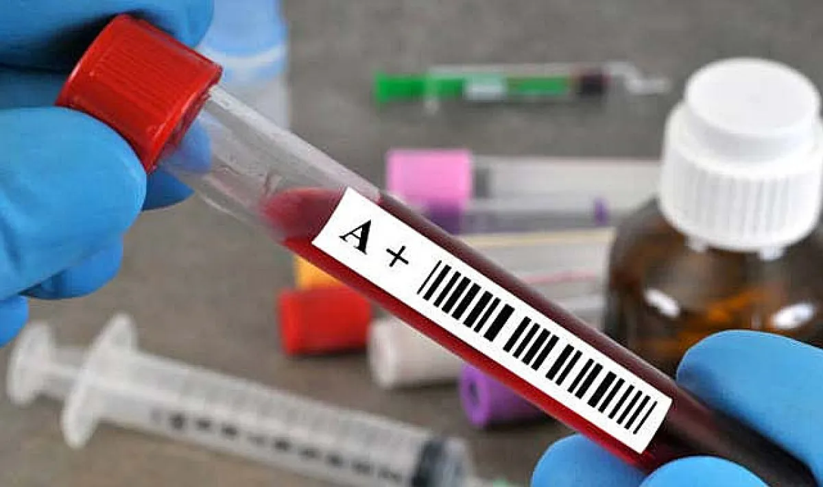 Kan Grubuna Göre En Ideal Meslekler Belli Oldu2