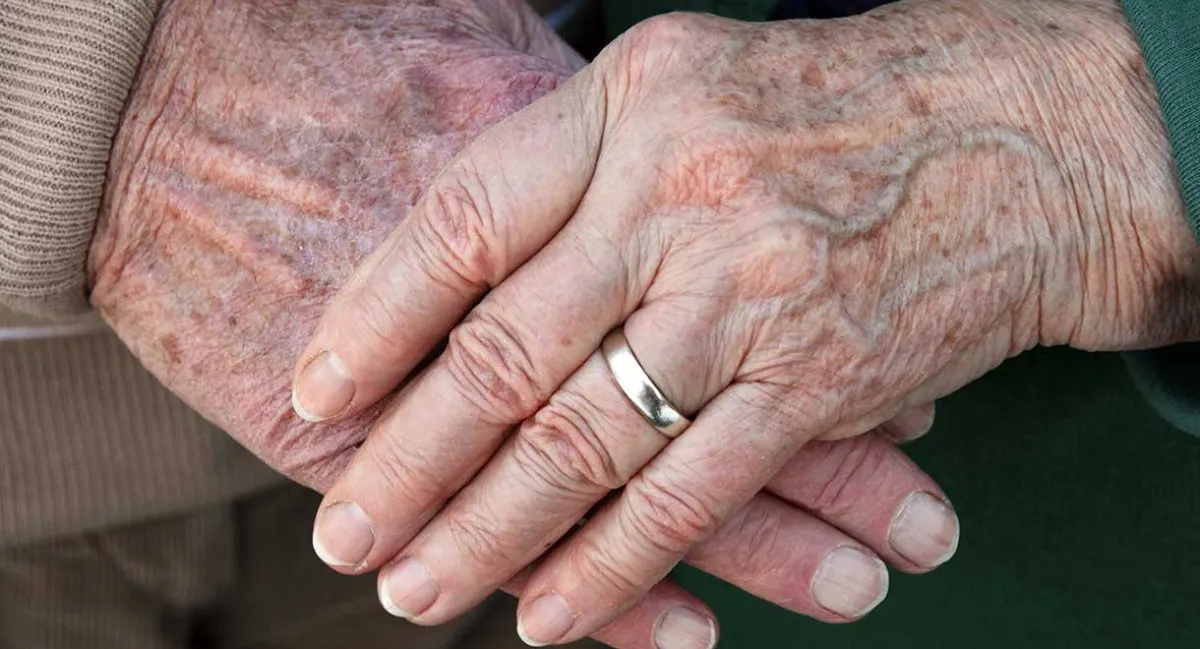 Günde 1 Kez Uygulayın, Yaşlılık Lekelerini Azaltın2