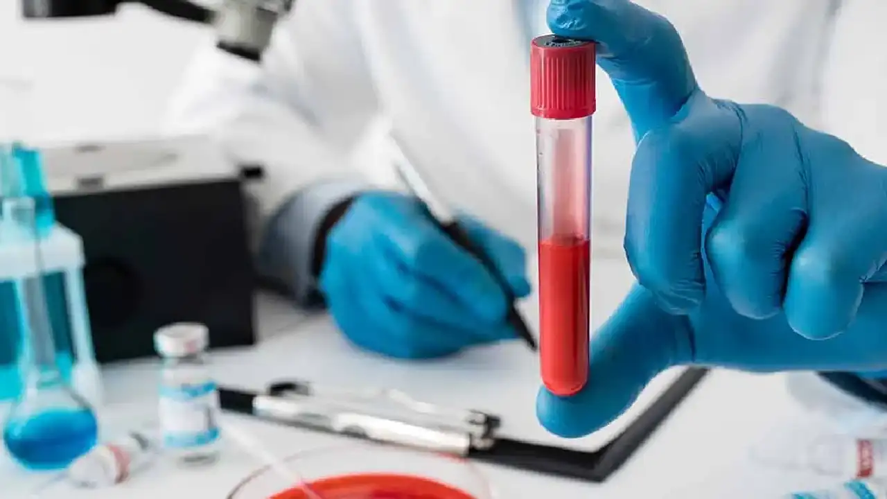 Kansızlık Belirtileri Bu 7 Sinyali Görmezden Gelmeyin