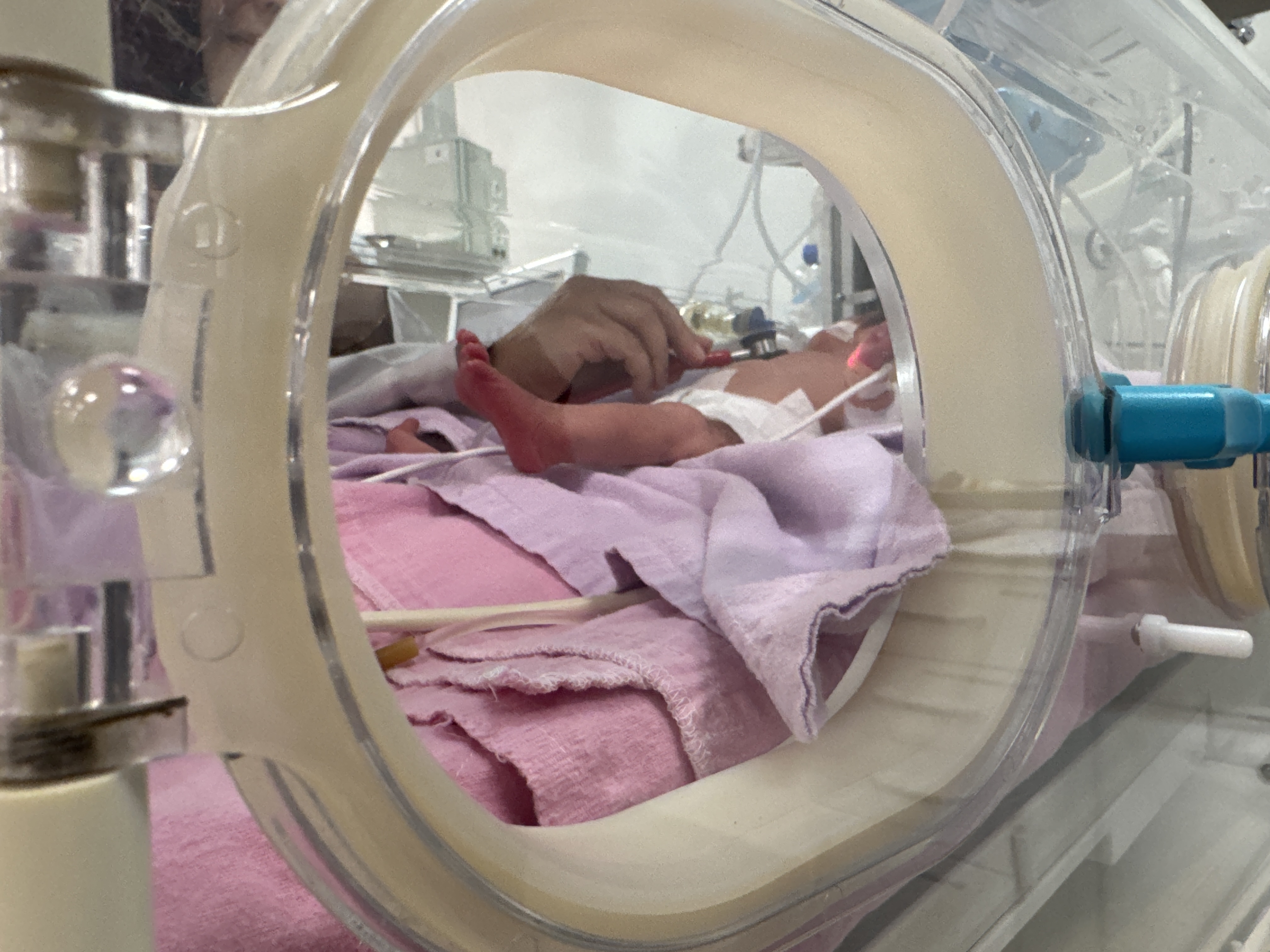 Prematüre bebekler anne şefkatiyle yaşama tutunuyor-3