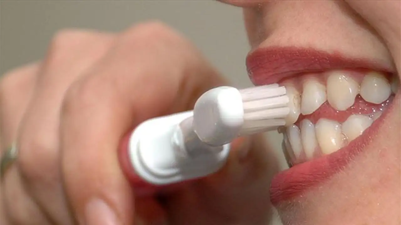 Önlenmeyen Diş Çürüğü Sistemik Hastalık Riskini Artırıyor 1