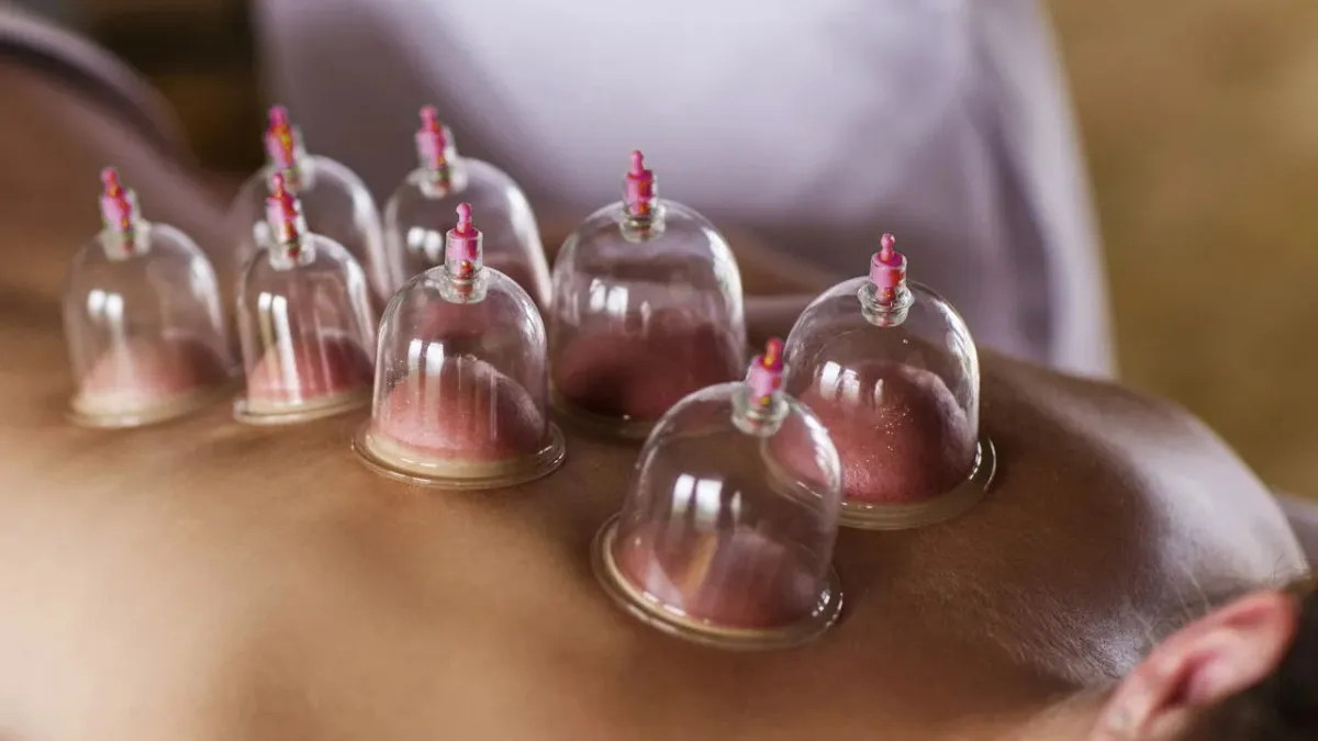 2025 Aralık Ayının Sünnetli Hacamat Günleri Açıklandı2