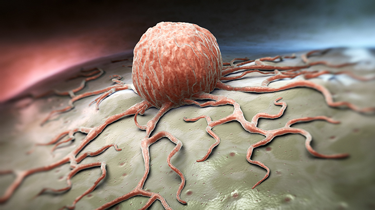 Az Gorulen 10 Kanser Artisa Gecti 5147 1